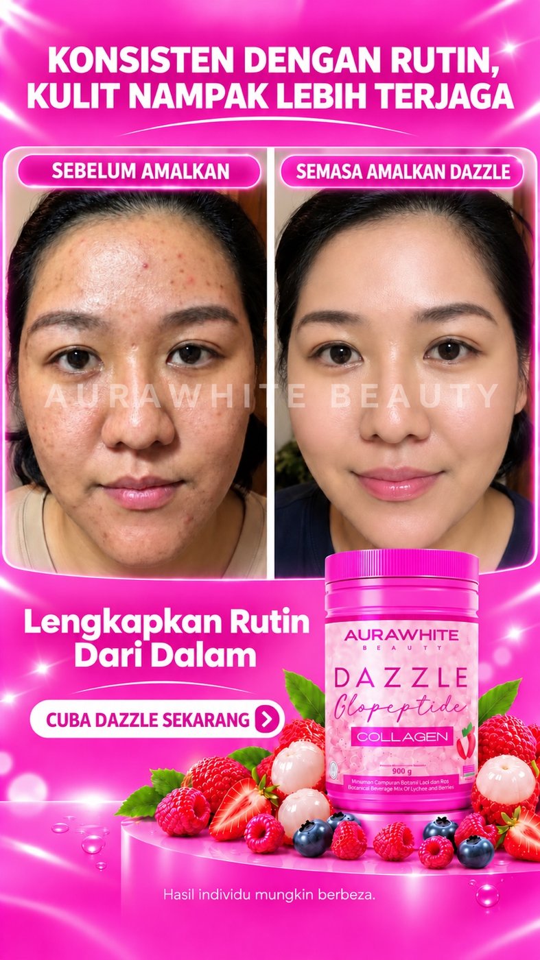 Testimoni rutin konsisten bersama Dazzle